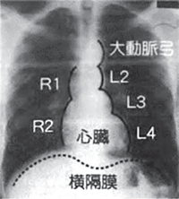 胸部X線検査