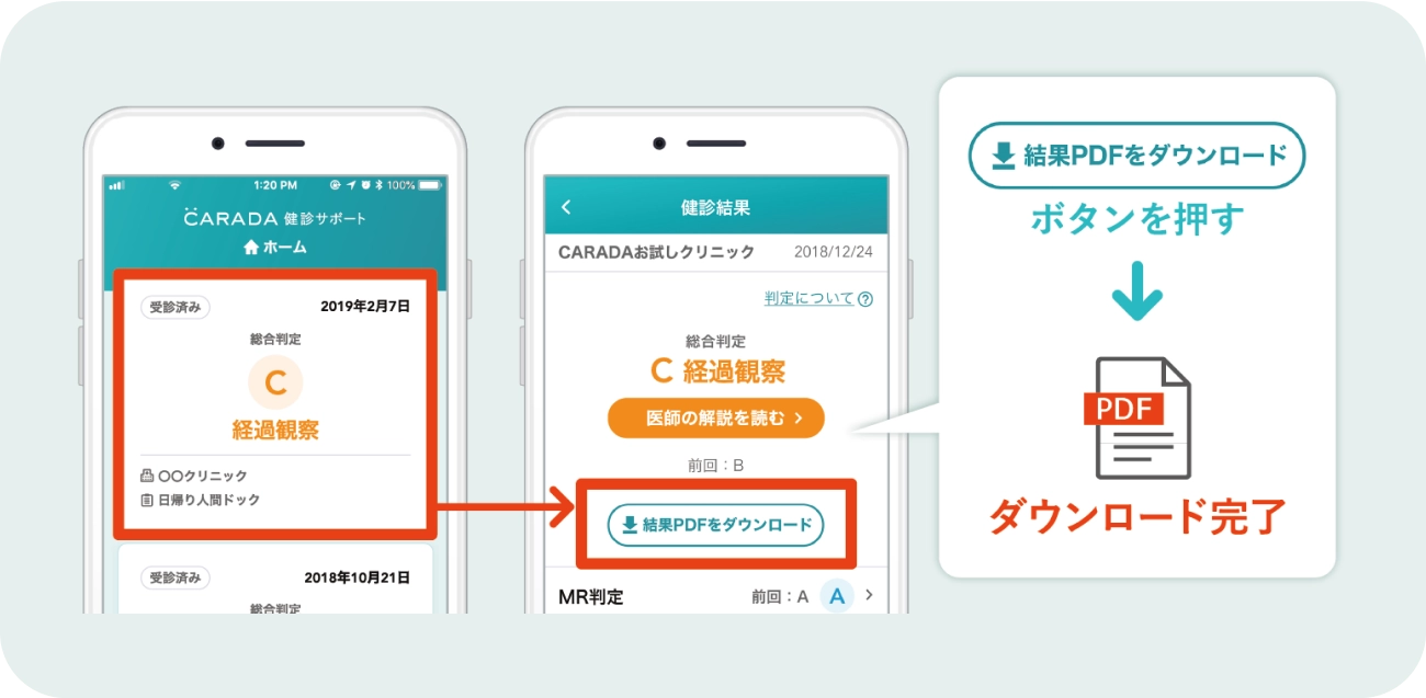 ダウンロードボタンをタップ